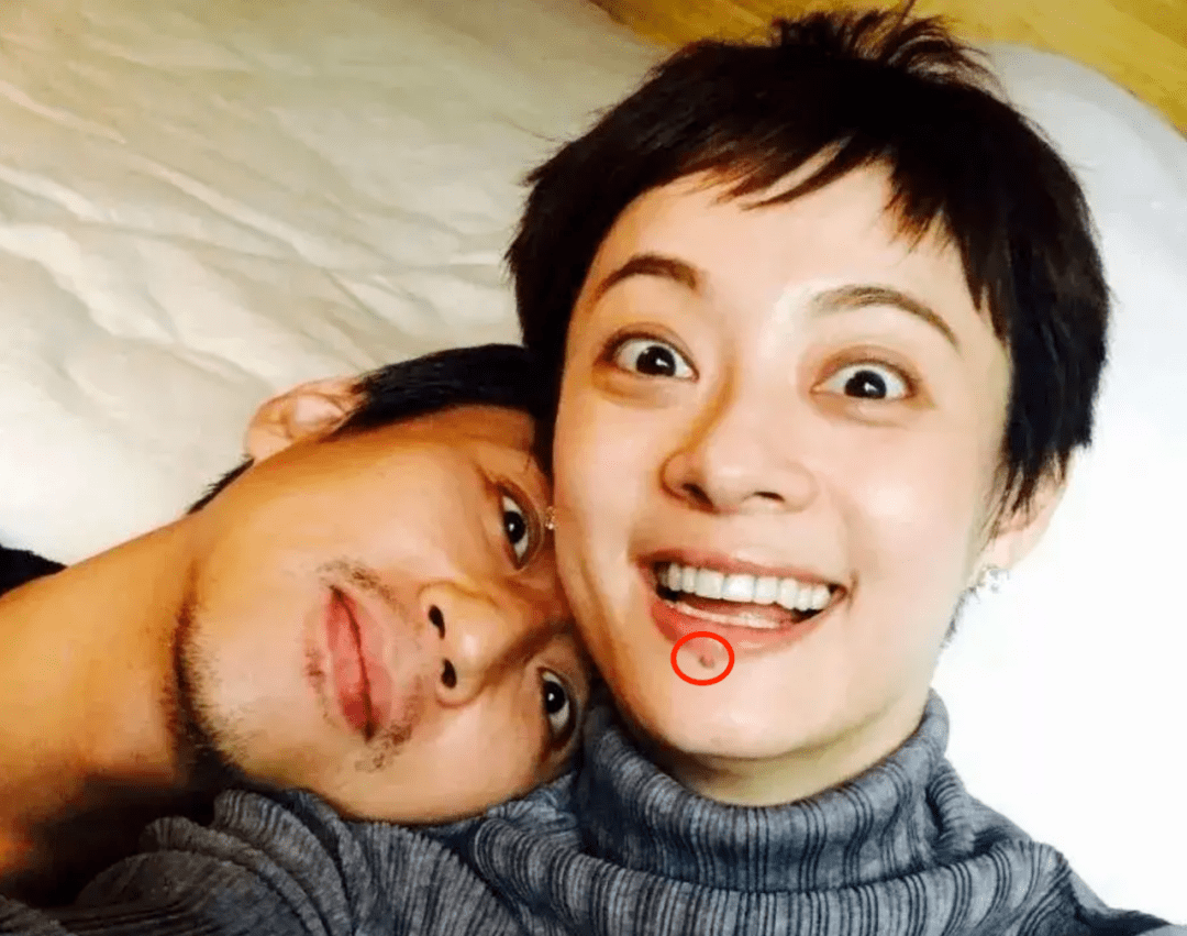 殷桃的唇上痣，孙俪的痦子，千玺的坑，明星的特点你认得出吗？_安崎_肖战_周冬雨|肖战|殷桃|痦子_新浪新闻