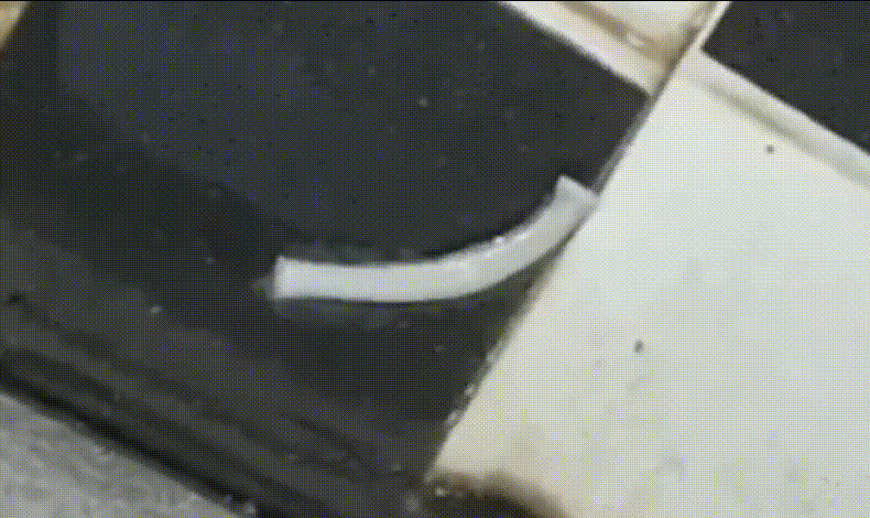 湖南一女子体内排出4.95米长绦虫 医生科普：慎吃生食休闲区蓝鸢梦想 - Www.slyday.coM