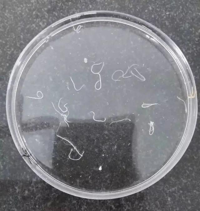异尖线虫图片当给娃吃了被污染的海鱼之后,异尖线虫的幼虫就有可能
