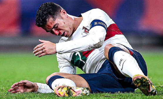 37岁c罗巅峰不再,仍获力挺:血洒赛场无愧精神领袖|c罗|良机|葡萄牙队