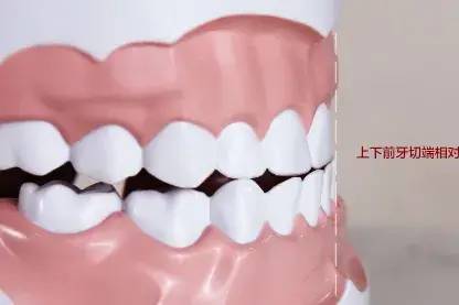 男子不到40岁，牙齿竟然全掉光！这个坏习惯很多人都有休闲区蓝鸢梦想 - Www.slyday.coM