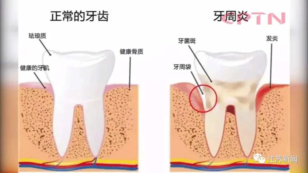 男子不到40岁，牙齿竟然全掉光！这个坏习惯很多人都有休闲区蓝鸢梦想 - Www.slyday.coM