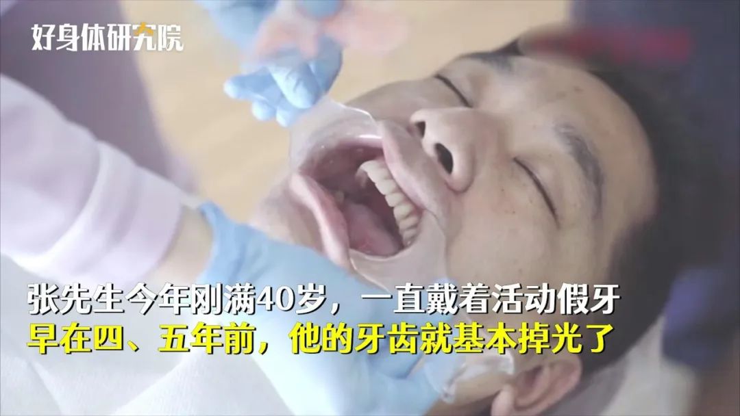 男子不到40岁，牙齿竟然全掉光！这个坏习惯很多人都有休闲区蓝鸢梦想 - Www.slyday.coM