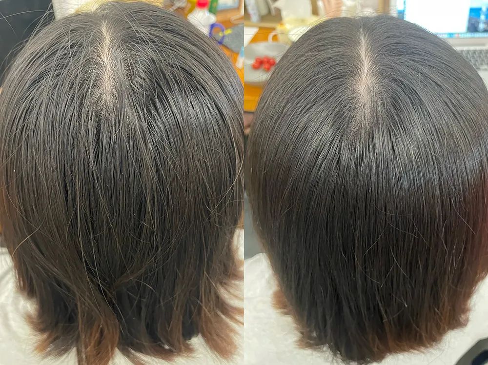 头皮专用“酸奶精华”，稳住贫瘠的头顶，长效控油丨种草机休闲区蓝鸢梦想 - Www.slyday.coM