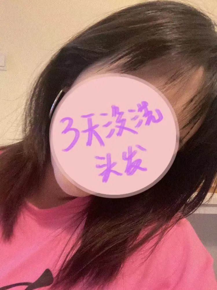 头皮专用“酸奶精华”，稳住贫瘠的头顶，长效控油丨种草机休闲区蓝鸢梦想 - Www.slyday.coM