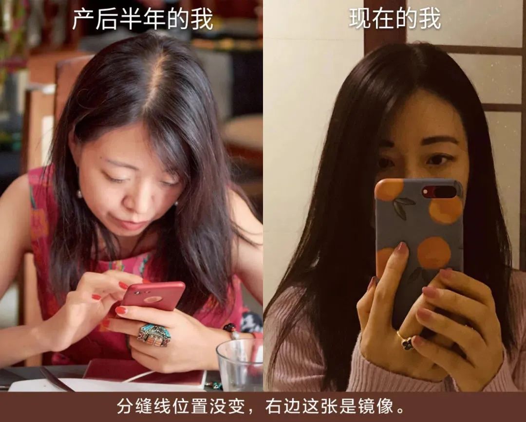 头皮专用“酸奶精华”，稳住贫瘠的头顶，长效控油丨种草机休闲区蓝鸢梦想 - Www.slyday.coM