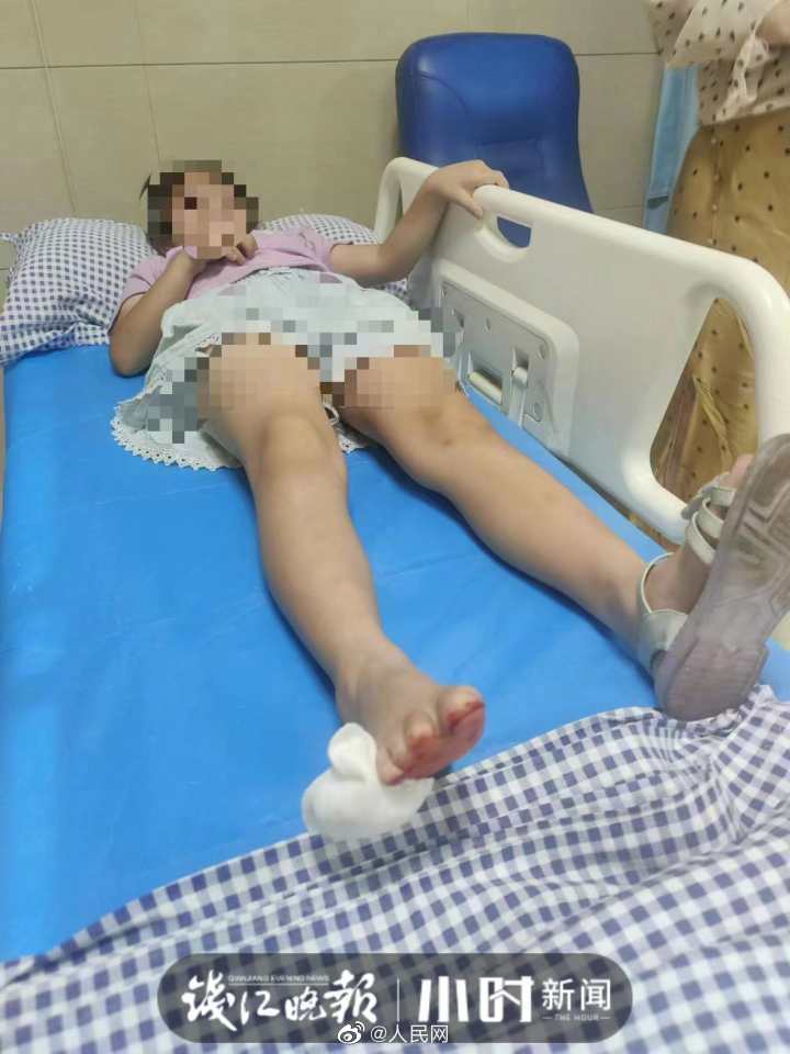 小区24楼掉下哈士奇砸伤老人孩子休闲区蓝鸢梦想 - Www.slyday.coM