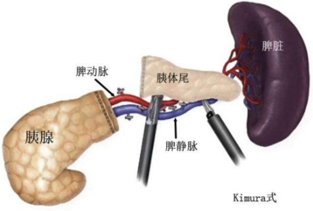 邵医微创休闲区蓝鸢梦想 - Www.slyday.coM