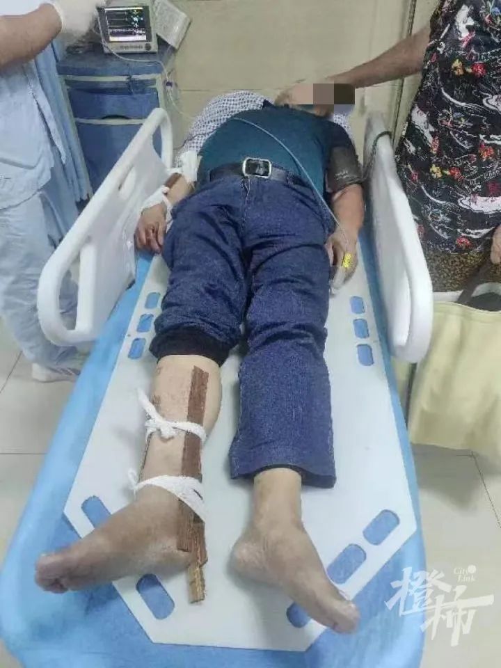 24楼突然掉下哈士奇！老人孩子被砸伤，“倒在地上起不来”休闲区蓝鸢梦想 - Www.slyday.coM