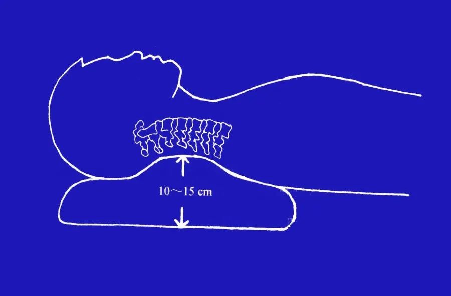 关于颈椎病的诊断及治疗，读这篇就够了！休闲区蓝鸢梦想 - Www.slyday.coM