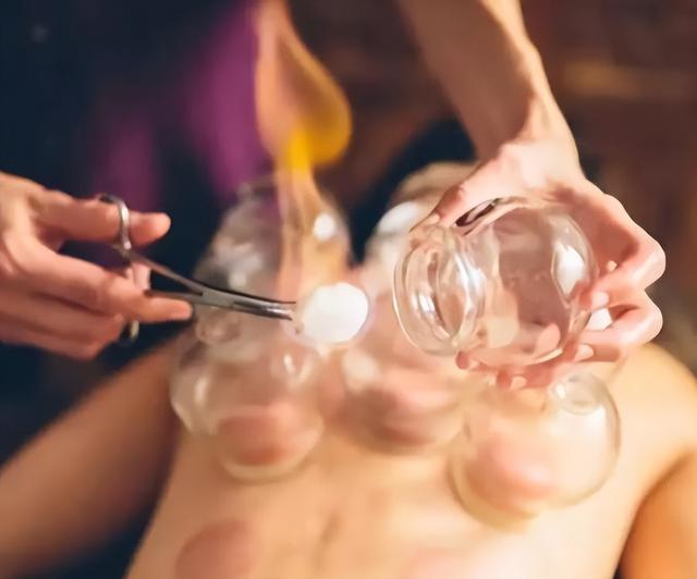 拔火罐吸出来的瘀血，是身体里的毒素吗？现在告诉你真相，看完涨知识！休闲区蓝鸢梦想 - Www.slyday.coM