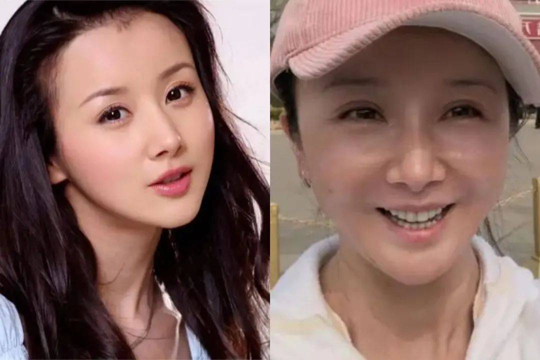 那些削骨的女星还好吗？脸歪僵硬、挂不住肉，杨幂、鞠婧祎都崩了！休闲区蓝鸢梦想 - Www.slyday.coM