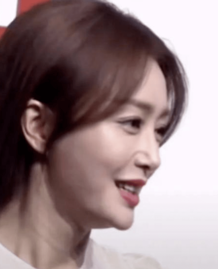 那些削骨的女星还好吗？脸歪僵硬、挂不住肉，杨幂、鞠婧祎都崩了！休闲区蓝鸢梦想 - Www.slyday.coM