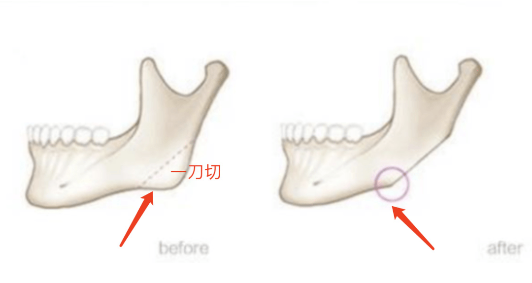 那些削骨的女星还好吗？脸歪僵硬、挂不住肉，杨幂、鞠婧祎都崩了！休闲区蓝鸢梦想 - Www.slyday.coM