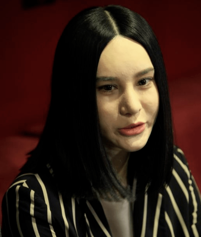 那些削骨的女星还好吗？脸歪僵硬、挂不住肉，杨幂、鞠婧祎都崩了！休闲区蓝鸢梦想 - Www.slyday.coM