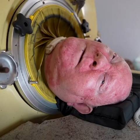 video|被困铁桶70年的"铁肺人":成为了律师,还环游世界