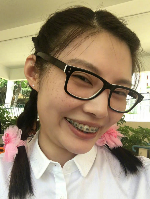 徐冬冬晒大量丑照自黑!箍牙套笑满脸雀斑,身材圆润双下巴突出