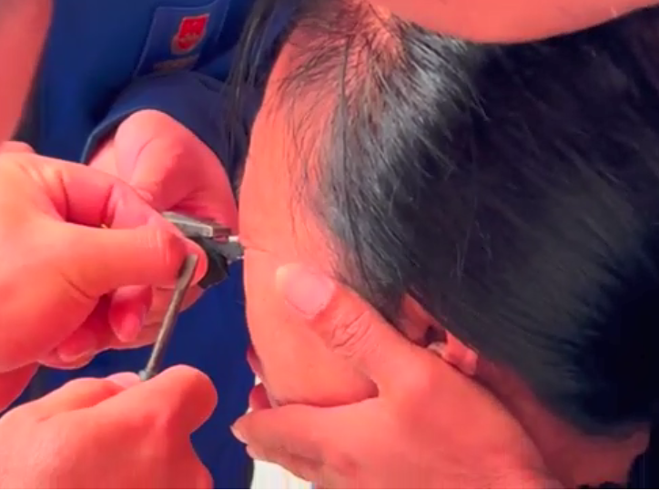 隔着屏幕都疼！浙江阿婆被拉链卡住眼皮！螺丝刀、老虎钳齐上场休闲区蓝鸢梦想 - Www.slyday.coM