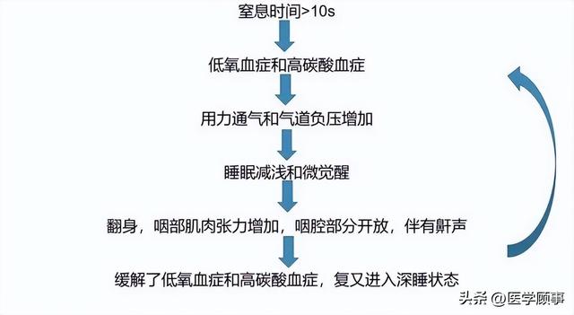 鼾症（OSAHS阻塞性睡眠呼吸暂停低通气综合征）的治疗休闲区蓝鸢梦想 - Www.slyday.coM