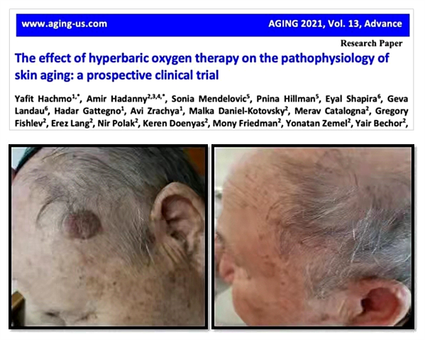 图/实验成果发表于《Aging》及参与者实验前后对比图