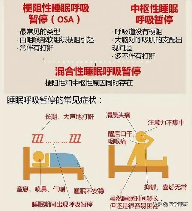 鼾症（OSAHS阻塞性睡眠呼吸暂停低通气综合征）的治疗休闲区蓝鸢梦想 - Www.slyday.coM
