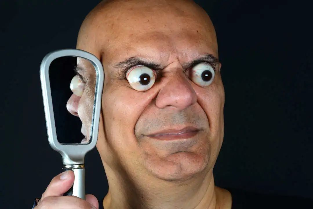 "眼睛瞪得像铜铃":世界上眼球最突出的人!__财经头条