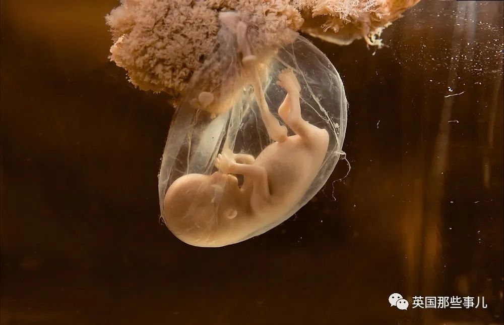 9周大就被堕掉的"胎儿"到底长啥样?医生甩出一组照片,惊呆众人!