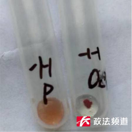 罕见！比“熊猫血”更稀有，长沙发现一例“恐龙血”血型休闲区蓝鸢梦想 - Www.slyday.coM