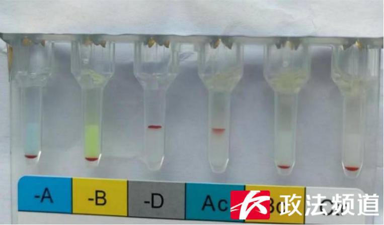 罕见！比“熊猫血”更稀有，长沙发现一例“恐龙血”血型休闲区蓝鸢梦想 - Www.slyday.coM