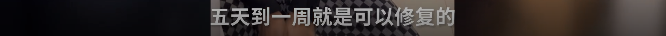 沪上最时髦的“社交神器”！但已有多人因此受伤...三甲医院专家最新提醒→休闲区蓝鸢梦想 - Www.slyday.coM