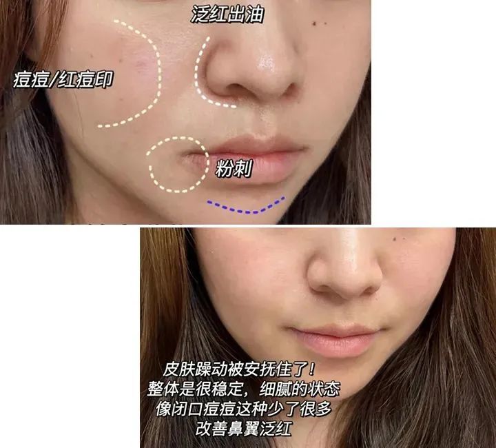 等了很久的，海蓝之谜新版精粹水福利来啦！休闲区蓝鸢梦想 - Www.slyday.coM