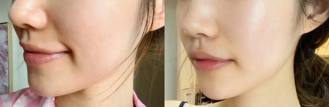 等了很久的，海蓝之谜新版精粹水福利来啦！休闲区蓝鸢梦想 - Www.slyday.coM