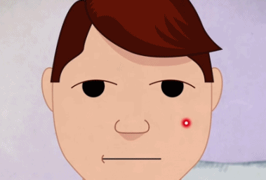 悲剧了！男孩挤痘引发脑膜炎，“危险三角区”到底有多危险？休闲区蓝鸢梦想 - Www.slyday.coM