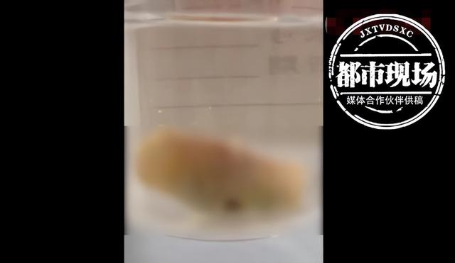 顿顿吃肉！67岁大叔血管里堵了一块4厘米长的黄色“油脂”休闲区蓝鸢梦想 - Www.slyday.coM