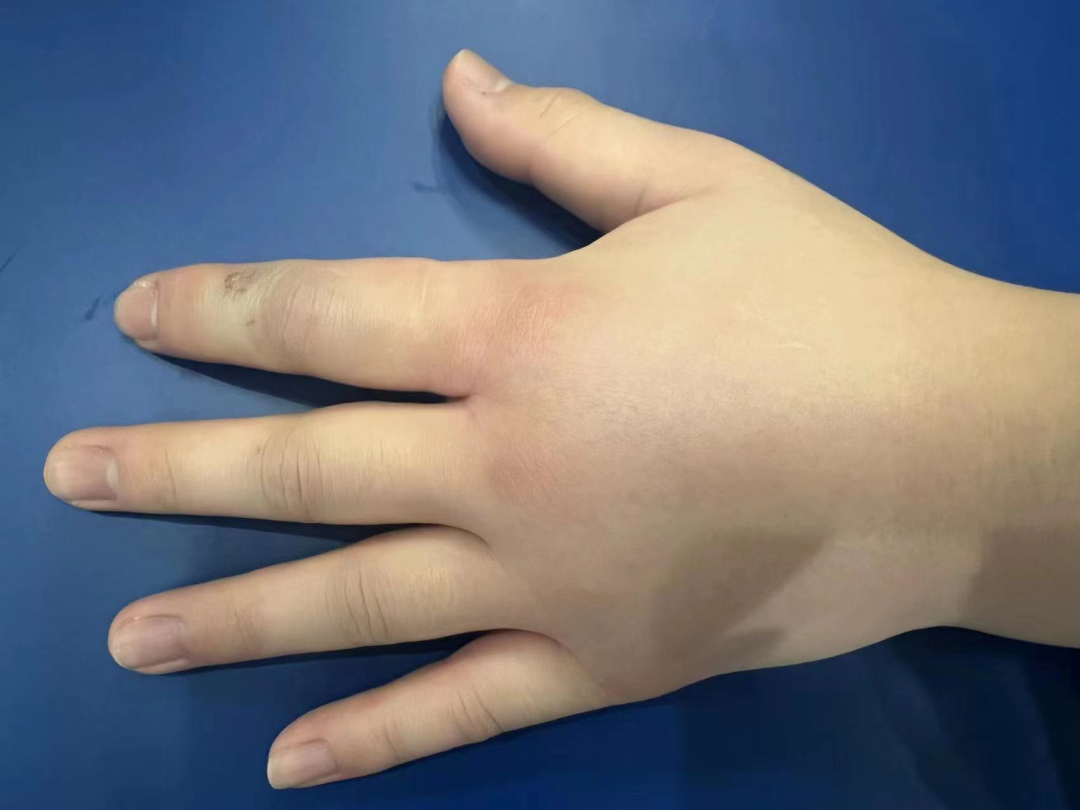 拿竹叶青当宠物,今日凌晨,一市民进了急诊抢救室|患者|蛇_新浪新闻