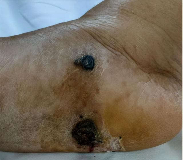 男子查出恶性肿瘤，竟与3年前的一次小意外有关休闲区蓝鸢梦想 - Www.slyday.coM