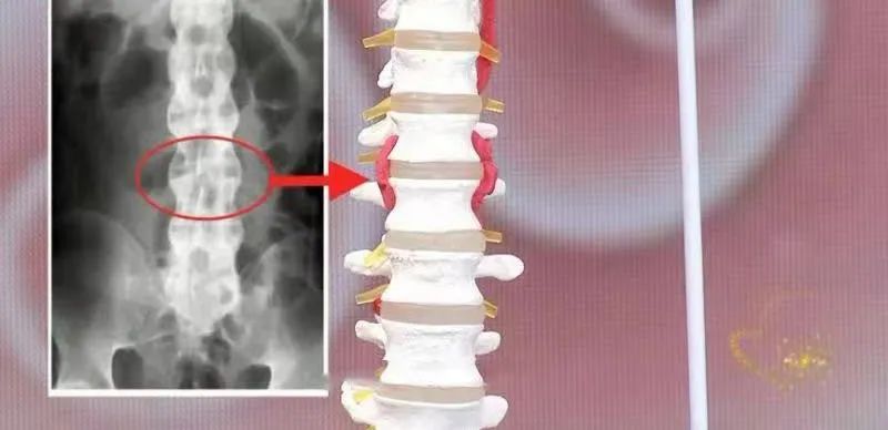 后背疼，别以为是累的，可能与多种病有关！一文读懂不同位置的疼痛信号休闲区蓝鸢梦想 - Www.slyday.coM