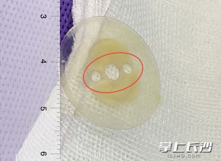 10月男婴“肺炎”久治不愈，原来是这个东西惹的祸休闲区蓝鸢梦想 - Www.slyday.coM