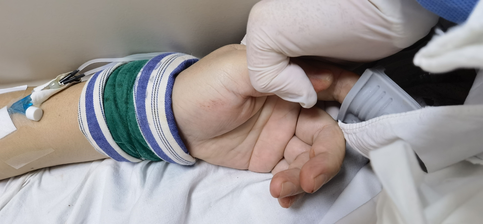 吃了冰箱里的变质腌制食品，一男子全身和血液都变成了蓝黑色休闲区蓝鸢梦想 - Www.slyday.coM