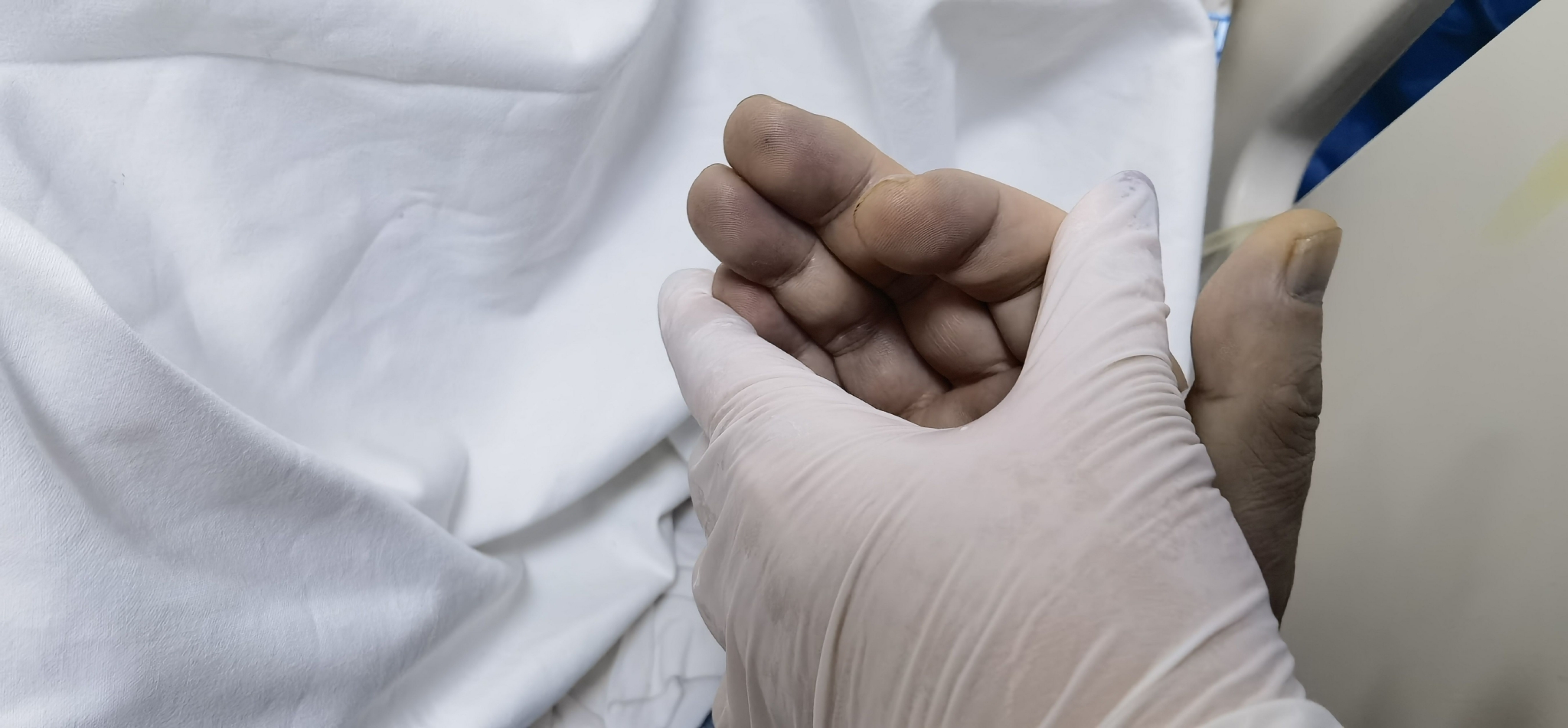 吃了冰箱里的变质腌制食品，一男子全身和血液都变成了蓝黑色休闲区蓝鸢梦想 - Www.slyday.coM