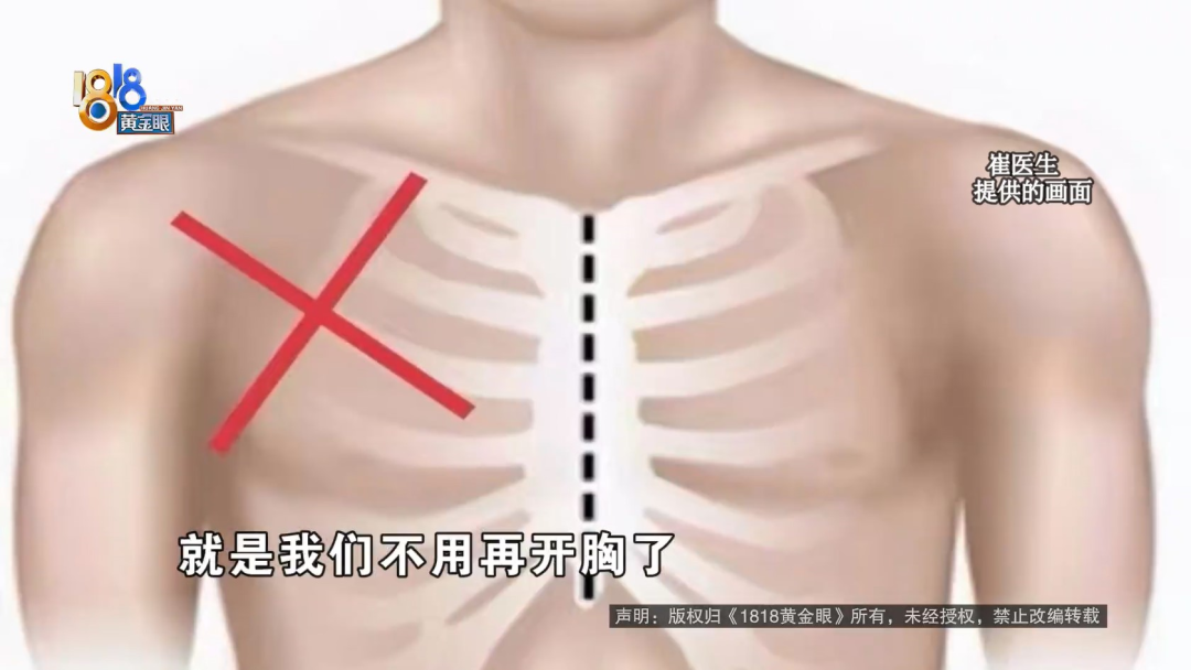 半年笑晕了四次  心里是真“堵得慌”休闲区蓝鸢梦想 - Www.slyday.coM