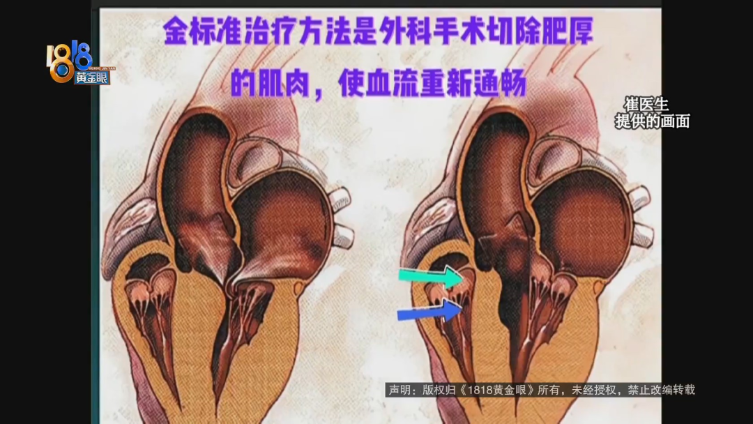 半年笑晕了四次  心里是真“堵得慌”休闲区蓝鸢梦想 - Www.slyday.coM