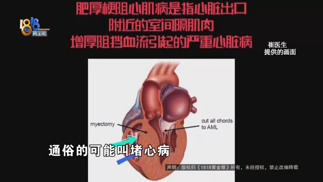 半年笑晕了四次  心里是真“堵得慌”休闲区蓝鸢梦想 - Www.slyday.coM