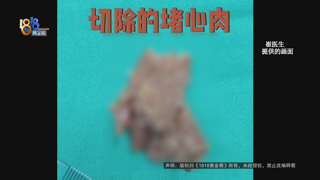 半年笑晕了四次  心里是真“堵得慌”休闲区蓝鸢梦想 - Www.slyday.coM