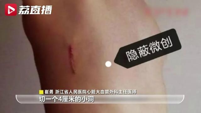女子半年“笑晕”4次住进医院！医生：这是一种病，平均每500人就有一例休闲区蓝鸢梦想 - Www.slyday.coM