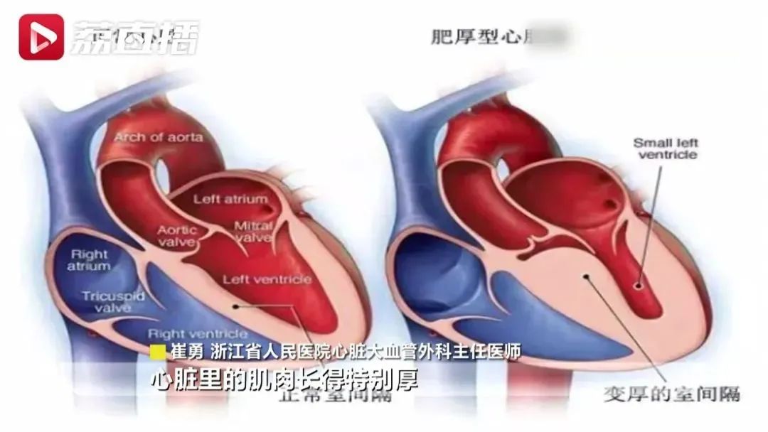 阿姨半年“笑晕”4次进医院，医生：是病！平均每500人就有一例休闲区蓝鸢梦想 - Www.slyday.coM