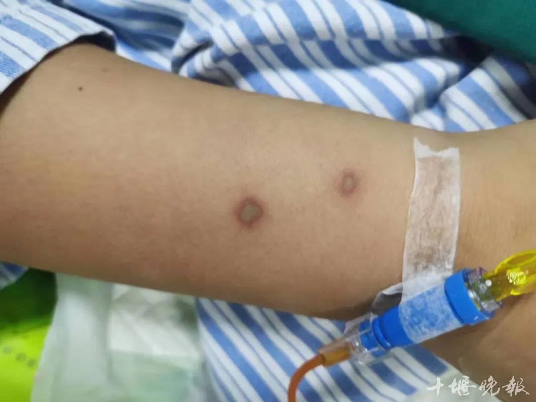 伤停情况影响双方排兵布阵