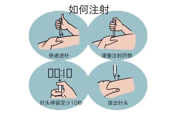 因为腹部皮下的吸收速度较快,短效胰岛素(重组人胰岛素)注射部位首选