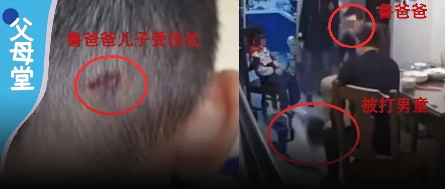 孩子起冲突受伤,家长讨理反打伤人被刑拘,这样极端的方式无法保护孩子|幼儿园|警情通报|打架|王家|打人_新浪新闻