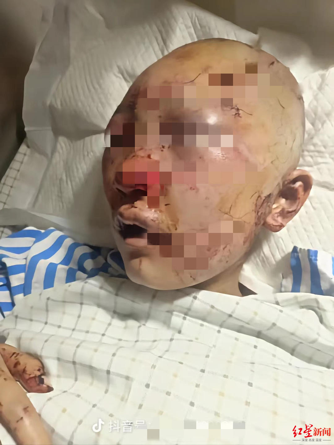 浙江永康20岁女生上公厕遭男子施暴！男子已被逮捕，家属称其卧室中找到女性衣物休闲区蓝鸢梦想 - Www.slyday.coM